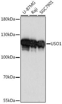 VDP p115 Antibody