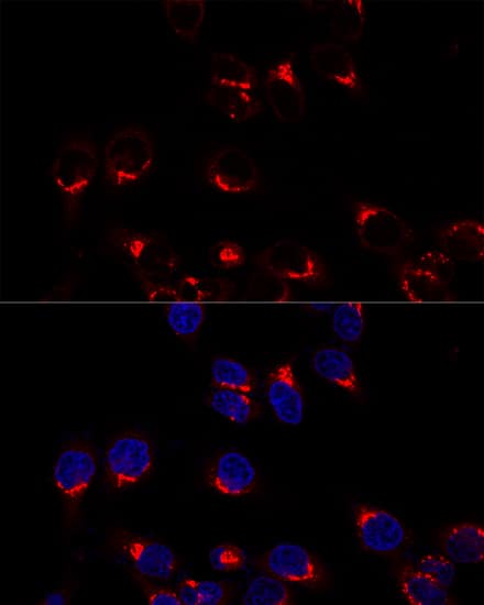 VDP p115 Antibody