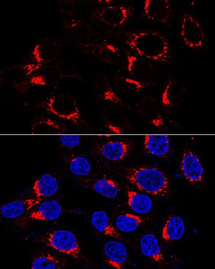 VDP p115 Antibody