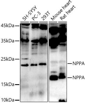 Atrial Natriuretic Peptide/ANP Antibody