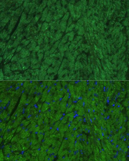Atrial Natriuretic Peptide/ANP Antibody