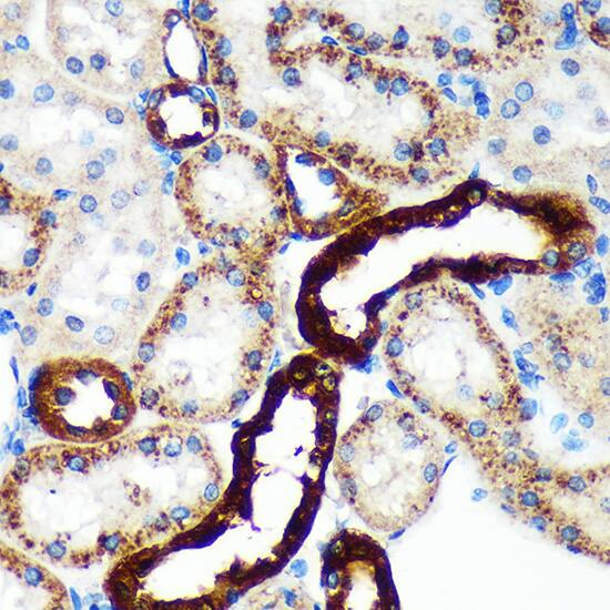 EML4 Antibody