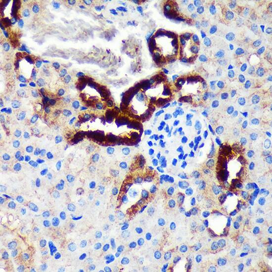 EML4 Antibody