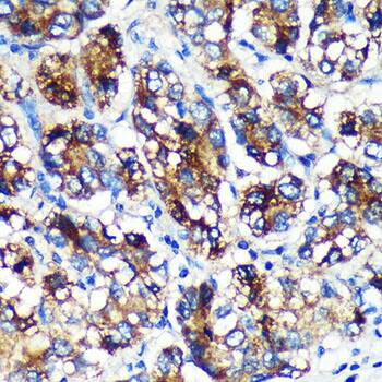 EML4 Antibody