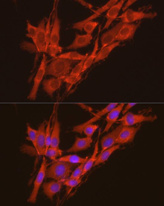 CKII alpha prime polypeptide Antibody