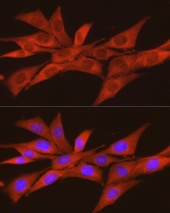 CKII alpha prime polypeptide Antibody