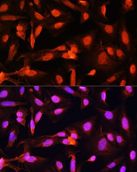 Shugoshin Antibody