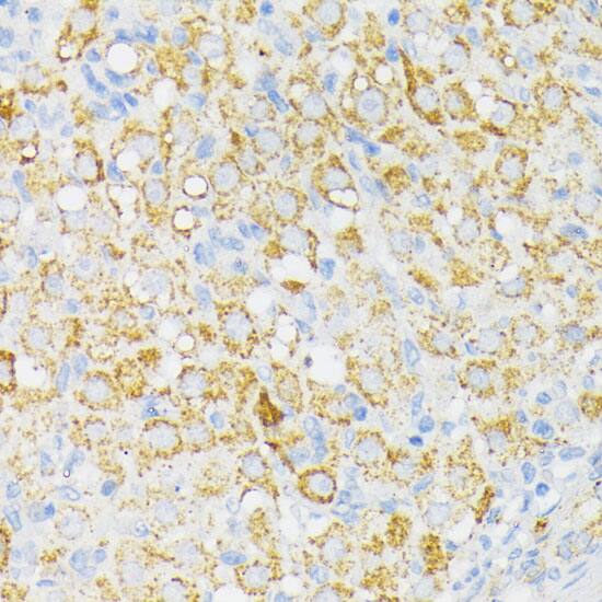 USP33 Antibody