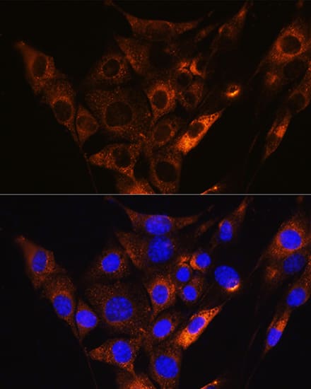 HCN1 Antibody