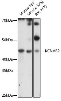 KvBeta2 Antibody