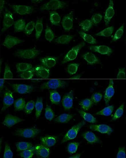 FALDH Antibody