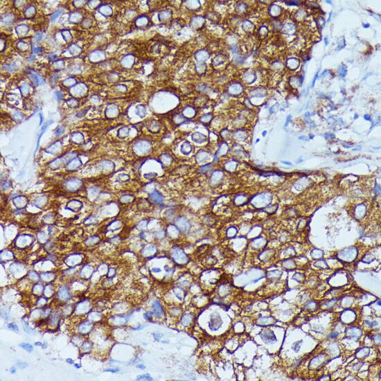 DDX6 Antibody