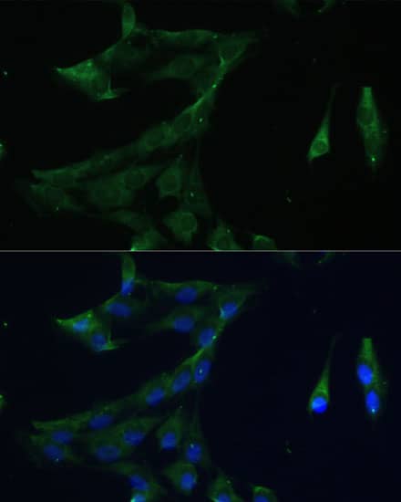 ARL3 Antibody