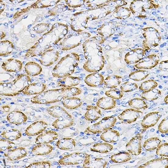NUBP1 Antibody