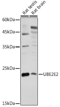 UBE2E2 Antibody