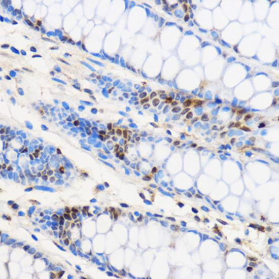 ZNF263 Antibody