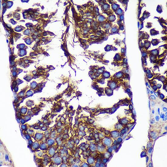 CTNNA3 Antibody