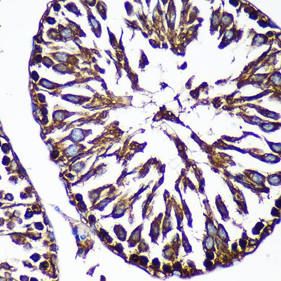 CTNNA3 Antibody