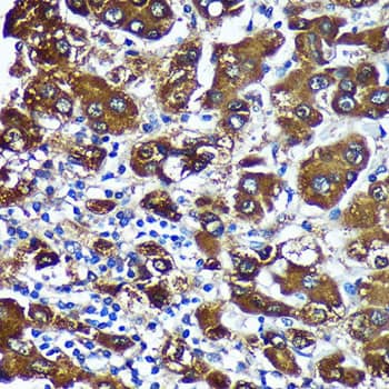 CTNNA3 Antibody