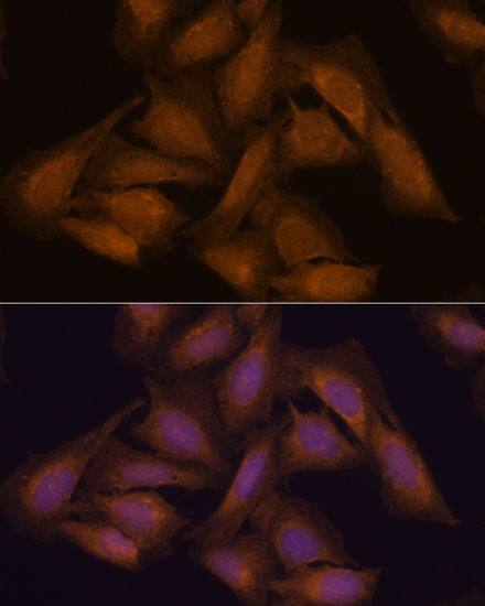 Septin-3 Antibody