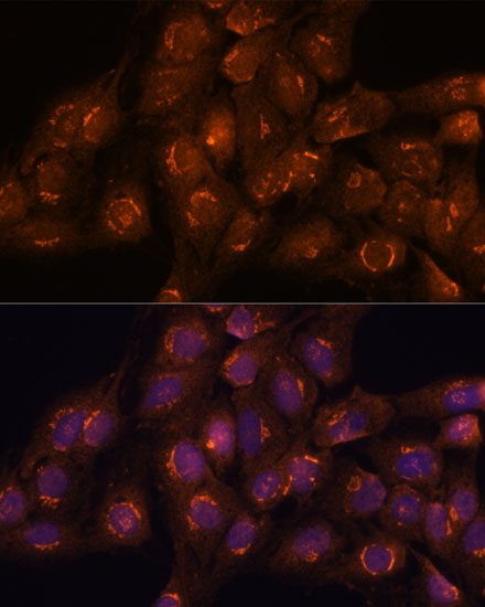 ACBD3 Antibody