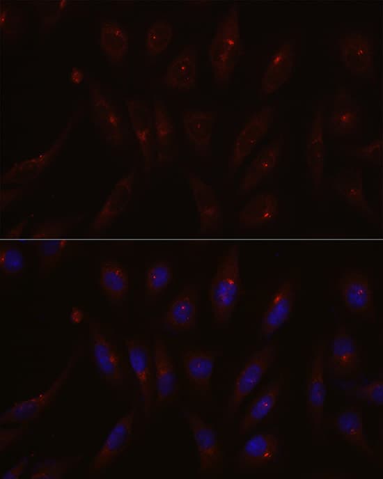 PCM1 Antibody