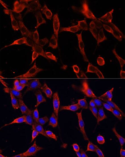 Fibrillin 1 Antibody