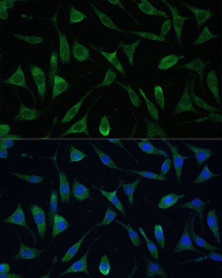 LSM14A Antibody