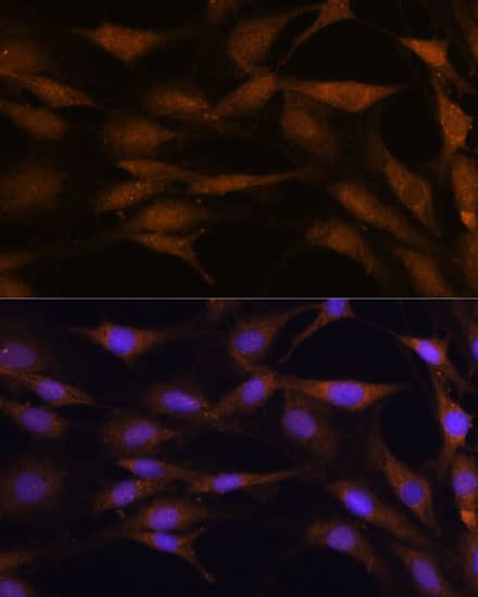 TFAP4 Antibody