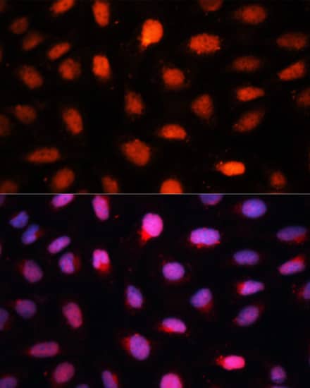 CTBP2 Antibody