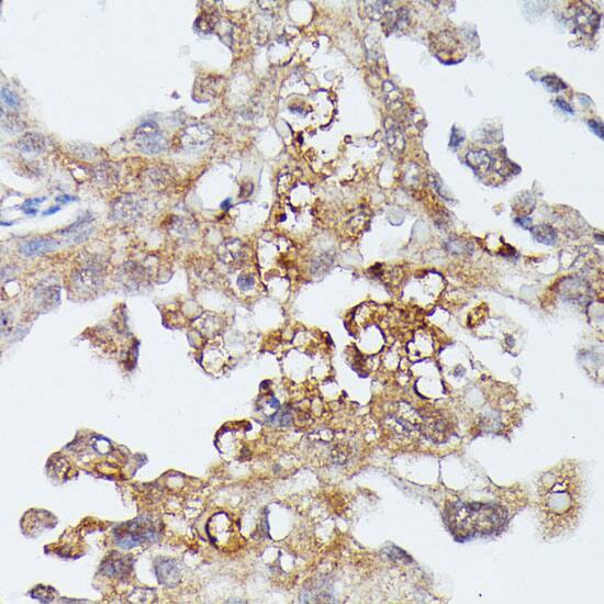 MEKK4 Antibody