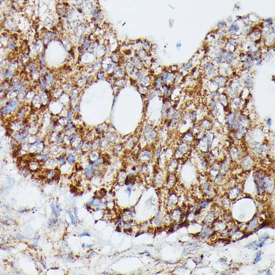 MEKK4 Antibody