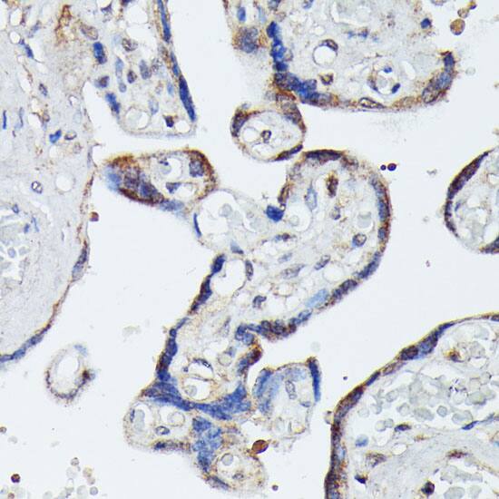 MEKK4 Antibody