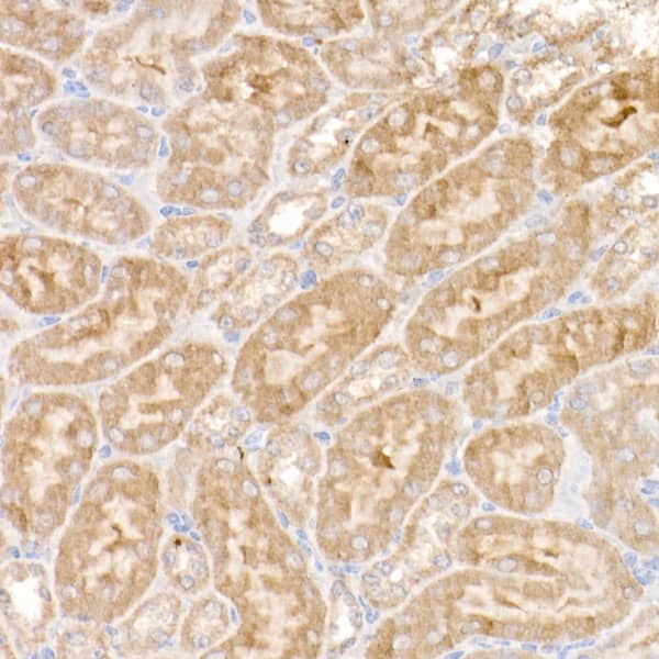 Ndufs1 Antibody