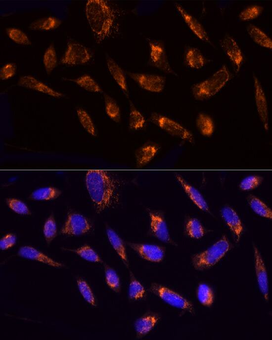 Ndufs1 Antibody