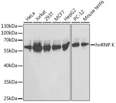 hnRNP K Antibody