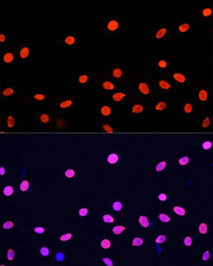 H4 Clustered Histone 1 Antibody