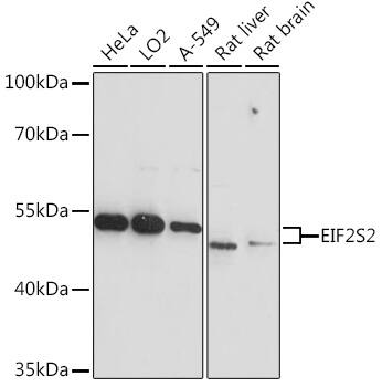 EIF2 beta Antibody