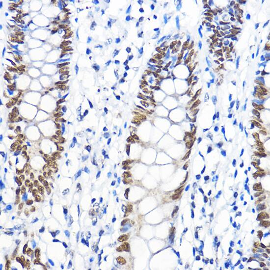 TFIIB Antibody