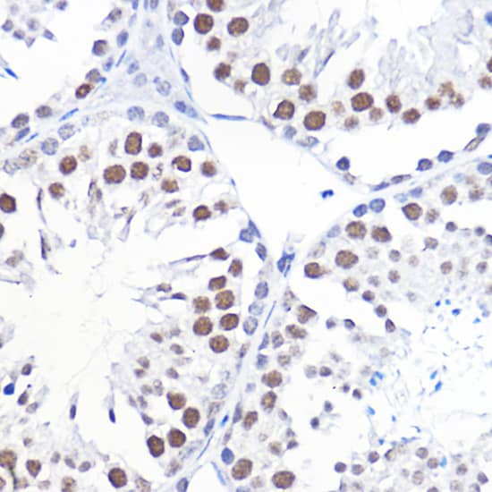 TFIIB Antibody