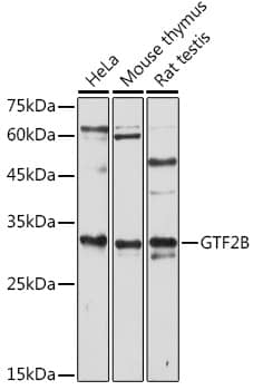 TFIIB Antibody