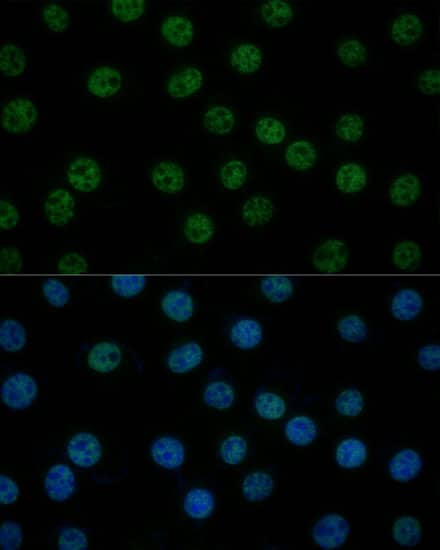 TFIIB Antibody