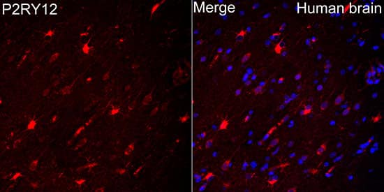 P2Y12/P2RY12 Antibody