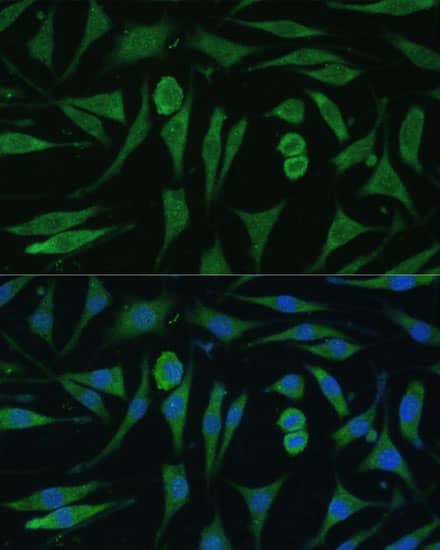 RAP6 Antibody