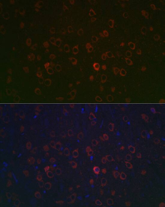 REEP2 Antibody