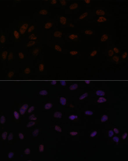 SMEK2 Antibody