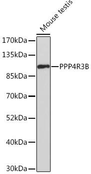 SMEK2 Antibody