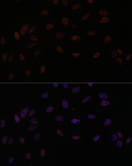 SMEK2 Antibody