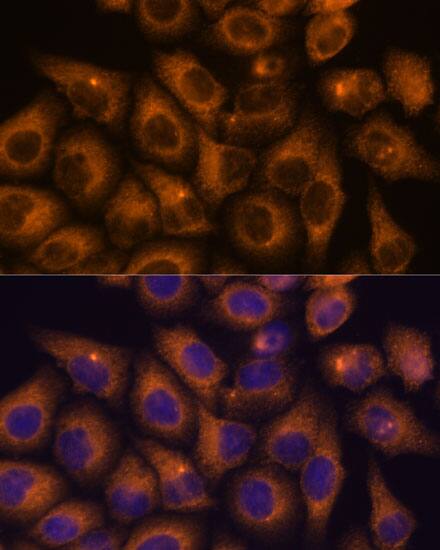 CaMKV Antibody