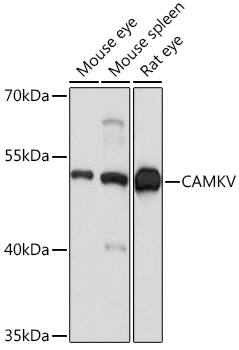 CaMKV Antibody